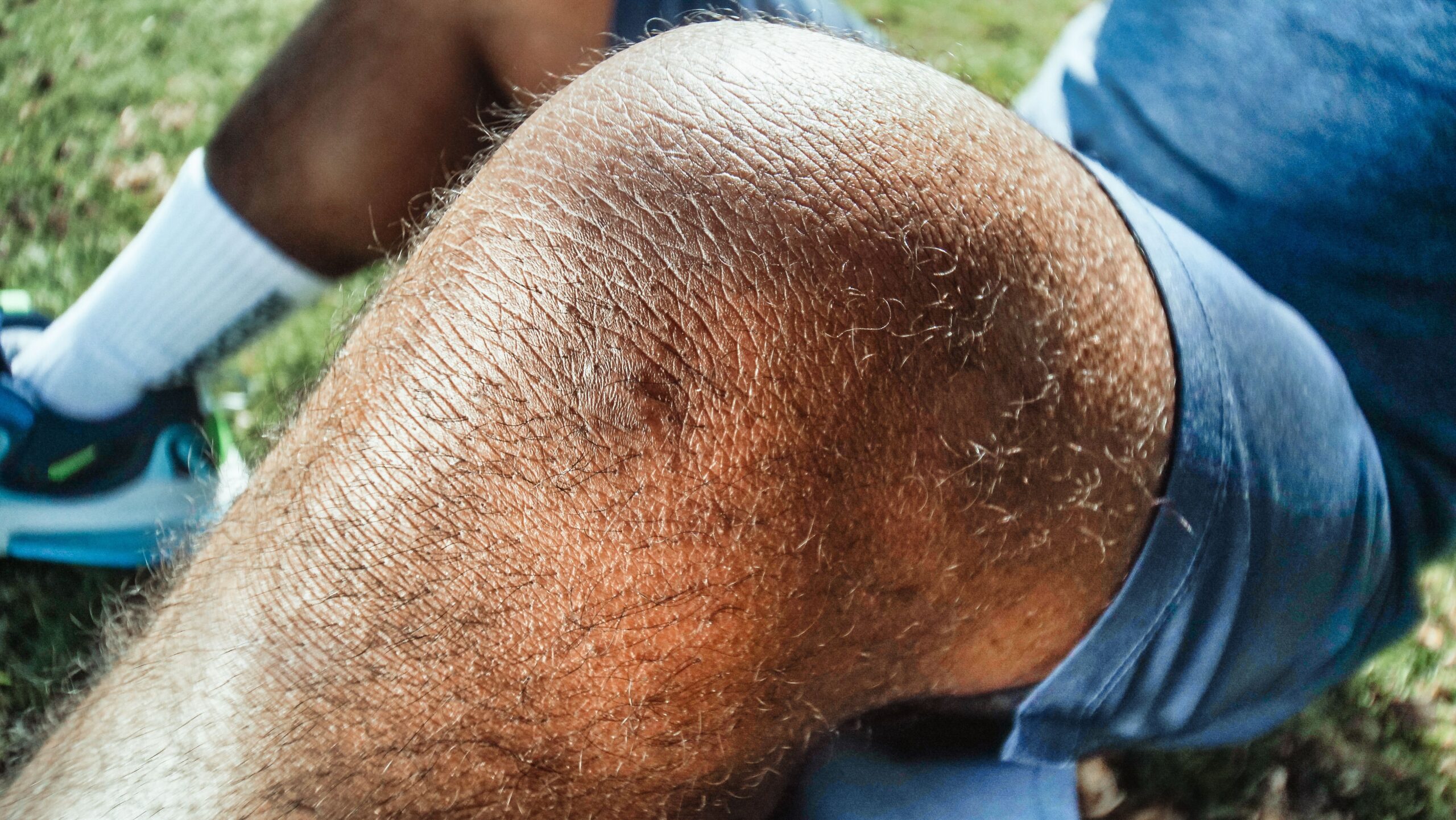 ACL Injury Rehabilitation Course